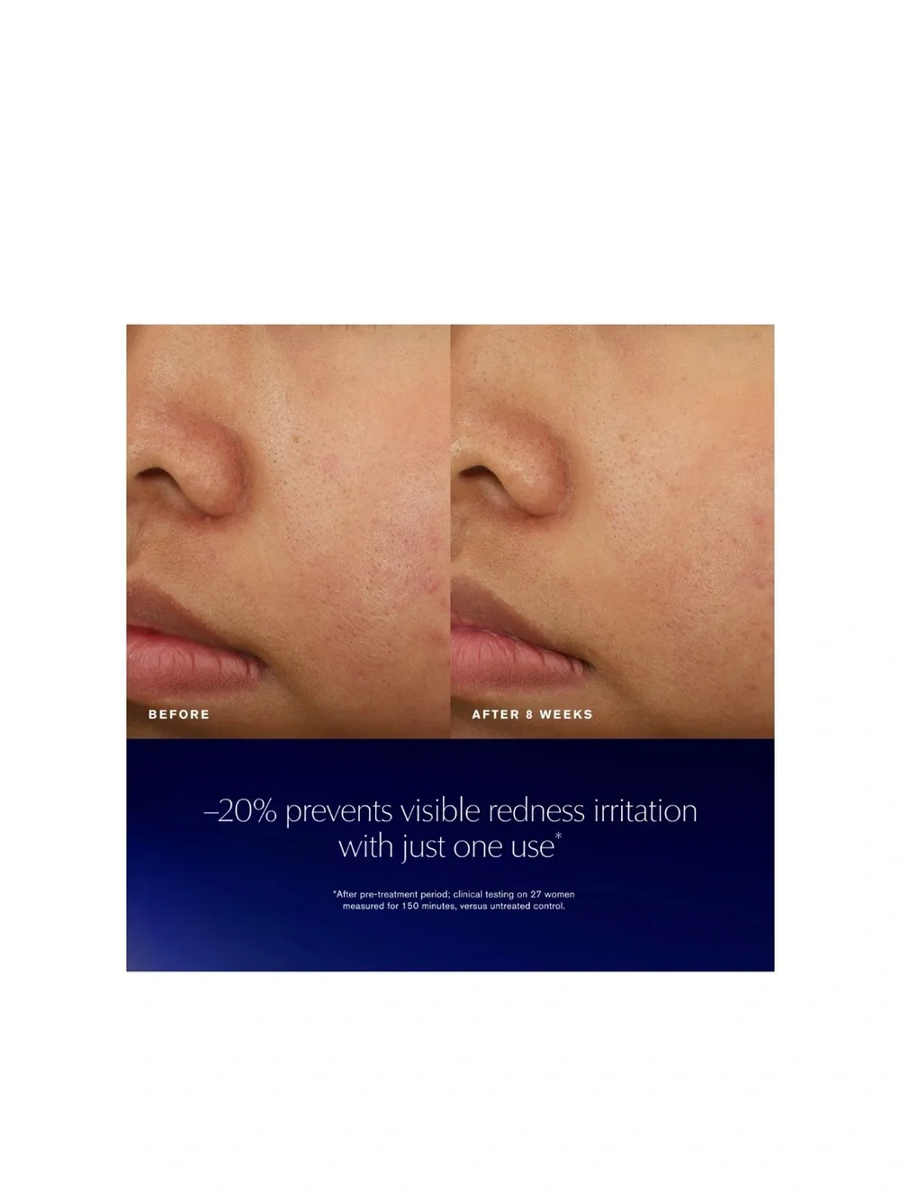 Estee Lauder bio exosome
